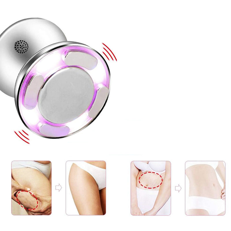 Cavitación Ultrasónica Nano IPL RF Adelgazante Anticelulitis